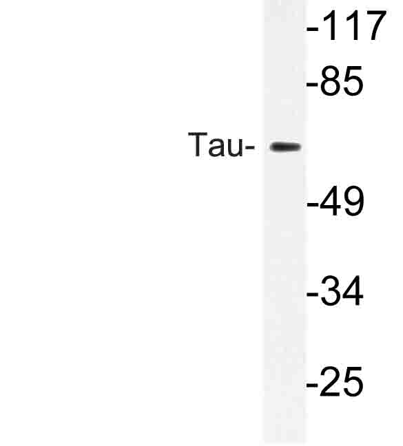 MAPT / Tau Antibody - Western blot of Tau (S527) pAb in extracts from rat brain cells.