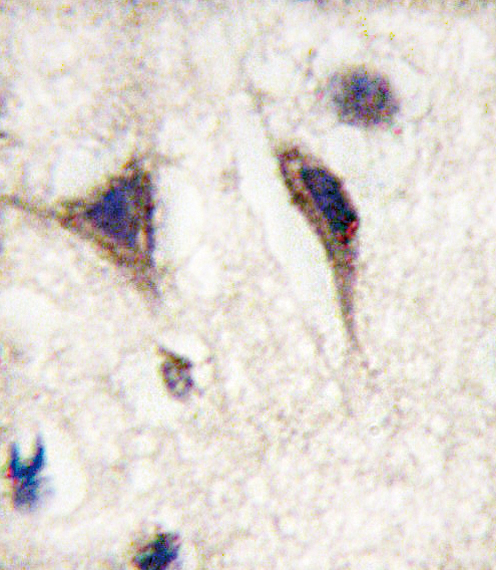 MAPT / Tau Antibody - Formalin-fixed and paraffin-embedded human brain tissue reacted with MAPT Antibody (S720) , which was peroxidase-conjugated to the secondary antibody, followed by DAB staining. This data demonstrates the use of this antibody for immunohistochemistry; clinical relevance has not been evaluated.