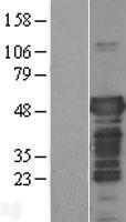 MAPT / Tau Protein - Western validation with an anti-DDK antibody * L: Control HEK293 lysate R: Over-expression lysate