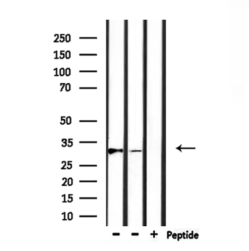 MARCH1 Antibody - Western blot analysis of extracts of rat muscle, mouse brain tissue using MARCH1 antibody.