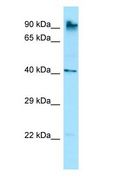 MARCH10 Antibody - MARCH10 antibody Western Blot of Rat Stomach.  This image was taken for the unconjugated form of this product. Other forms have not been tested.