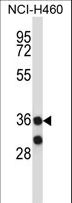 MARCH11 Antibody - MARCH11 Antibody western blot of NCI-H460 cell line lysates (35 ug/lane). The 40613 antibody detected the 40613 protein (arrow).