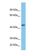 MARCH11 Antibody - Western blot of MARHB Antibody with human Fetal Kidney lysate.  This image was taken for the unconjugated form of this product. Other forms have not been tested.