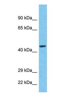 MARCH11 Antibody - Western blot of MARHB Antibody with human Fetal Kidney lysate.  This image was taken for the unconjugated form of this product. Other forms have not been tested.
