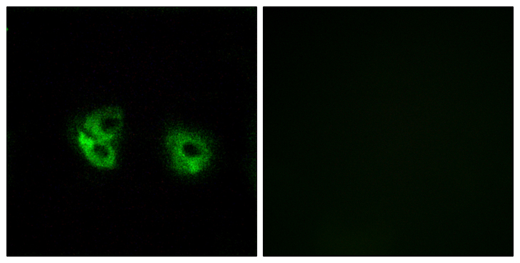 MARCH2 Antibody - Immunofluorescence analysis of A549 cells, using MARCH2 Antibody. The picture on the right is blocked with the synthesized peptide.