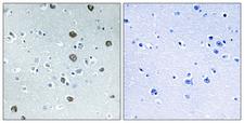 MARCH2 Antibody - Immunohistochemistry analysis of paraffin-embedded human brain tissue, using MARCH2 Antibody. The picture on the right is blocked with the synthesized peptide.