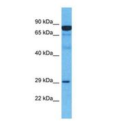 MARCH2 Antibody - Western blot of Human Esophagus Tumor. MARCH2 antibody dilution 1.0 ug/ml.  This image was taken for the unconjugated form of this product. Other forms have not been tested.