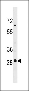 MARCH3 Antibody - MARH3 Antibody western blot of MDA-MB453 cell line lysates (35 ug/lane). The MARH3 antibody detected the MARH3 protein (arrow).