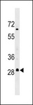 MARCH3 Antibody - MARH3 Antibody western blot of MDA-MB453 cell line lysates (35 ug/lane). The MARH3 antibody detected the MARH3 protein (arrow).