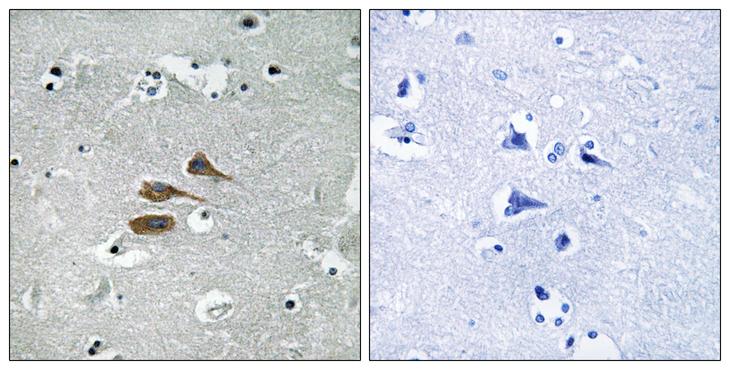 MARCH3 Antibody - Peptide - + Immunohistochemistry analysis of paraffin-embedded human brain tissue using MARCH3 antibody.