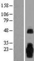 MARCH3 Protein - Western validation with an anti-DDK antibody * L: Control HEK293 lysate R: Over-expression lysate