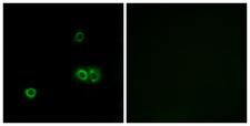MARCH5 Antibody - Immunofluorescence analysis of A549 cells, using MARCH5 Antibody. The picture on the right is blocked with the synthesized peptide.