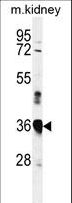 MARCH5 Antibody - Western blot of MARCH5 Antibody in mouse kidney tissue lysates (35 ug/lane). MARCH5 (arrow) was detected using the purified antibody.