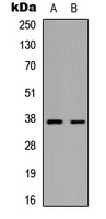 MARCH5 Antibody - Western blot analysis of 42068 expression in HepG2 (A); mouse brain (B) whole cell lysates.