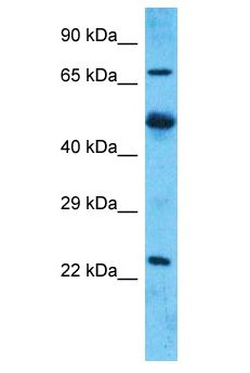 MARCH7 / Axotrophin Antibody - MARCH7 / Axotrophin antibody Western Blot of Uterus Tumor. Antibody dilution: 1 ug/ml.  This image was taken for the unconjugated form of this product. Other forms have not been tested.