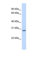 MARCH8 Antibody - MARCH8 antibody Western blot of Fetal Muscle lysate. This image was taken for the unconjugated form of this product. Other forms have not been tested.