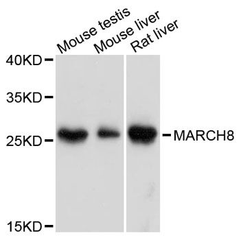 MARCH8 Antibody - Western blot analysis of extracts of various cell lines, using MARCH8 antibody at 1:3000 dilution. The secondary antibody used was an HRP Goat Anti-Rabbit IgG (H+L) at 1:10000 dilution. Lysates were loaded 25ug per lane and 3% nonfat dry milk in TBST was used for blocking. An ECL Kit was used for detection and the exposure time was 90s.