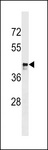 MARCH9 Antibody - MARCH9 Antibody western blot of SK-BR-3 cell line lysates (35 ug/lane). The MARCH9 antibody detected the MARCH9 protein (arrow).