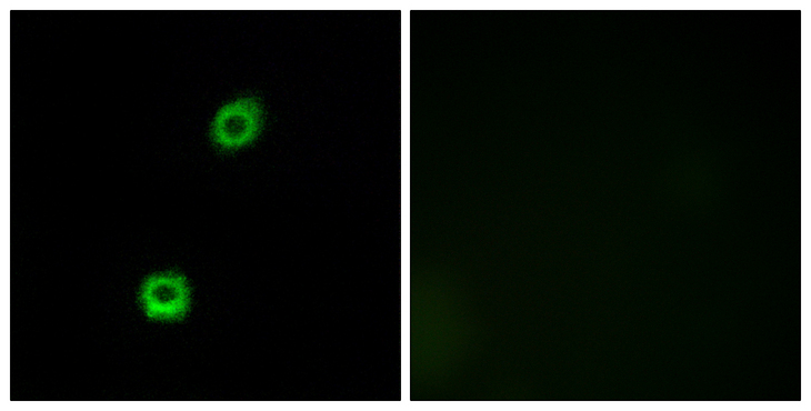 MARCKS Antibody - Immunofluorescence analysis of A549 cells, using MARCKS Antibody. The picture on the right is blocked with the synthesized peptide.