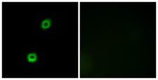 MARCKS Antibody - Immunofluorescence analysis of A549 cells, using MARCKS Antibody. The picture on the right is blocked with the synthesized peptide.