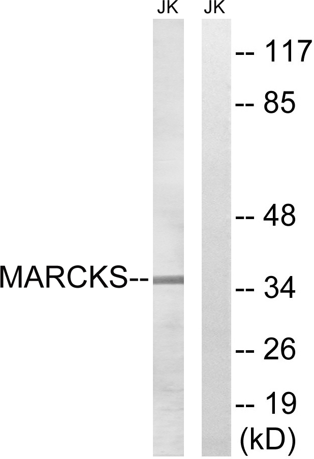 MARCKS Antibody - Western blot analysis of lysates from Jurkat cells, using MARCKS Antibody. The lane on the right is blocked with the synthesized peptide.
