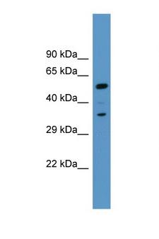MARCKS Antibody - MARCKS antibody Western blot of Fetal Liver lysate. Antibody concentration 1 ug/ml.  This image was taken for the unconjugated form of this product. Other forms have not been tested.