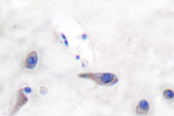 MARCKS Antibody - IHCanalysis of MARCKS (R157) pAb in paraffin-embedded human brain tissue.