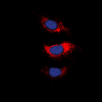 MARCKS Antibody - Immunofluorescent analysis of MARCKS staining in Jurkat cells. Formalin-fixed cells were permeabilized with 0.1% Triton X-100 in TBS for 5-10 minutes and blocked with 3% BSA-PBS for 30 minutes at room temperature. Cells were probed with the primary antibody in 3% BSA-PBS and incubated overnight at 4 deg C in a humidified chamber. Cells were washed with PBST and incubated with a DyLight 594-conjugated secondary antibody (red) in PBS at room temperature in the dark. DAPI was used to stain the cell nuclei (blue).