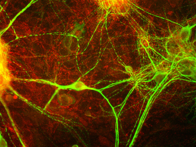 MARCKS Antibody - View of mixed neuron/glial cultures stained with our MARCKS antibody (red) and antibody to MAP2 made in chicken. Note that the MARCKS antibody stains vesicular structures both in the glial cells and in the dendrites of the neurons, which are strongly stained with the MAP2 antibody.
