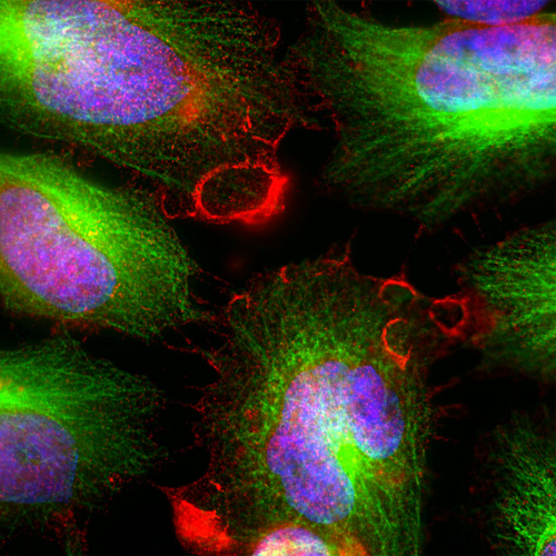 MARCKS Antibody - Immunolabeling of HeLa cells showing specific labeling of the MARCKs protein (anti-MARCKS antibody, red, 1:5000) and ß-tubulin protein (green). Anti-MARCKS binds MARCKs protein expressed in the plasma membrane and cytoplasm. The blue is Hoechst staining the nuclear DNA.