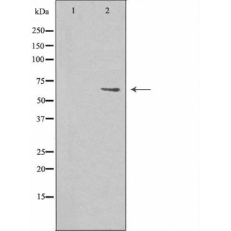 MARCKS Antibody - Western blot analysis of MARCKS expression in 293 cells. The lane on the left is treated with the antigen-specific peptide.