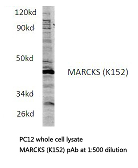 MARCKS Antibody - Western blot of MARCKS (K152) pAb in extracts from PC12 cells.
