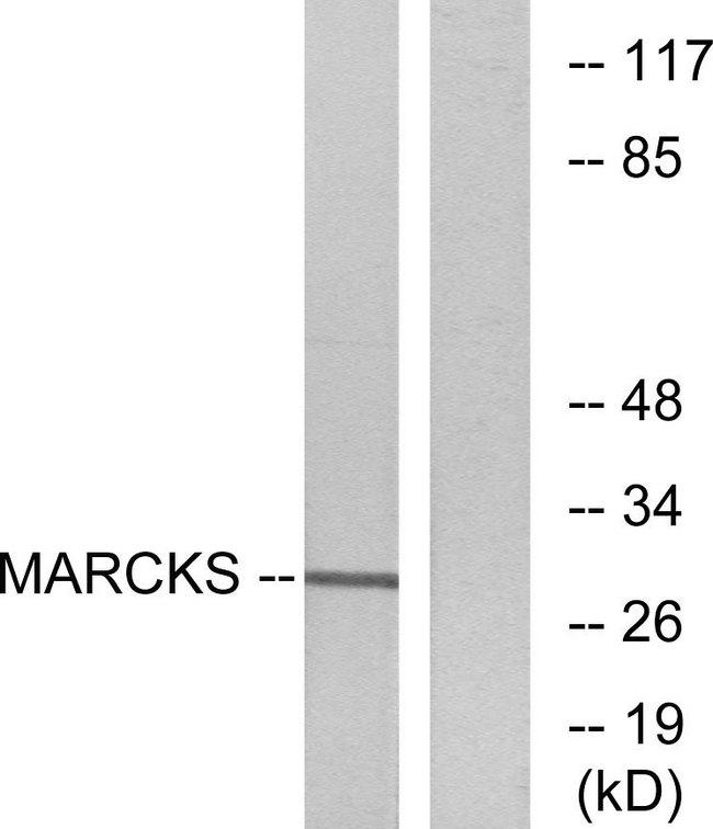 MARCKS Antibody - Western blot analysis of extracts from mouse brain cells, using MARCKS (Ab-158) antibody.