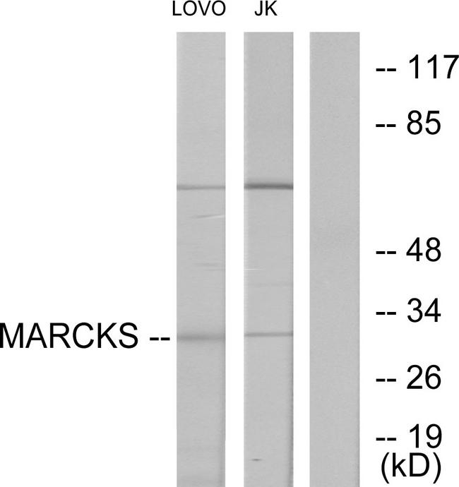 MARCKS Antibody - Western blot analysis of extracts from LOVO cells and Jurkat cells treated with PMA (125ng/ml, 30min), using MARCKS (Ab-162) antibody.