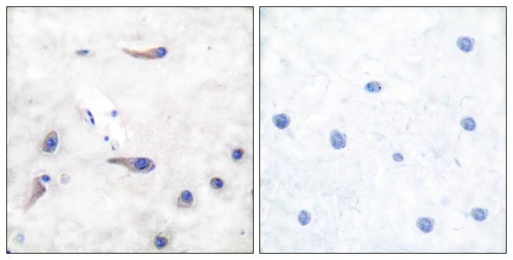 MARCKS Antibody - Peptide - + Immunohistochemical analysis of paraffin-embedded human brain tissue using MARCKS (Ab-162) antibody.