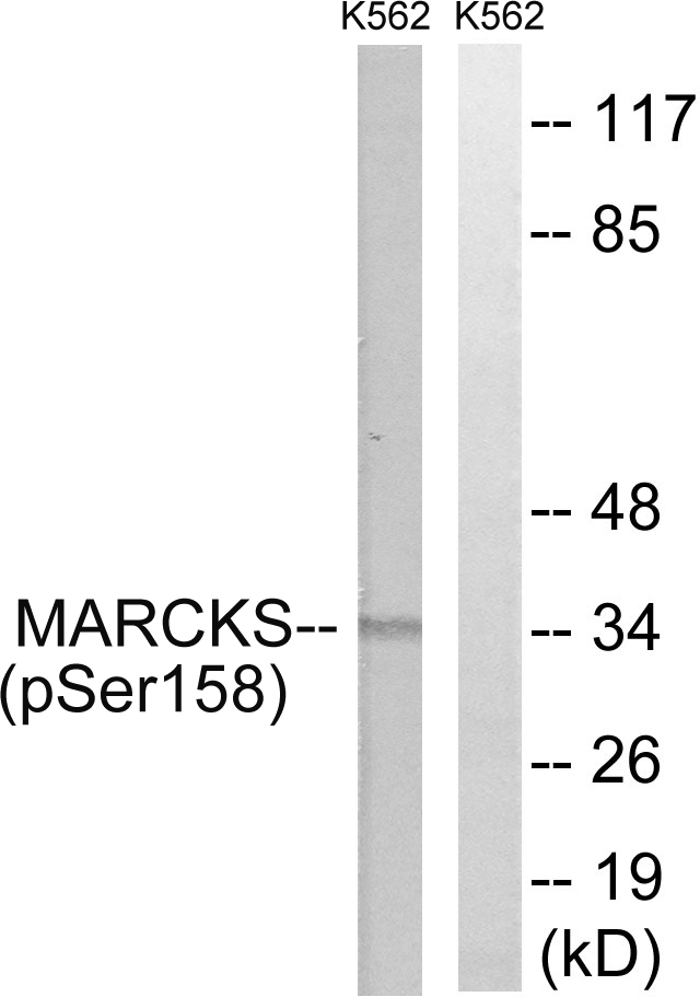 MARCKS Antibody - Western blot analysis of lysates from K562 cells treated with EGF 200ng/ml 30', using MARCKS (Phospho-Ser158) Antibody. The lane on the right is blocked with the phospho peptide.