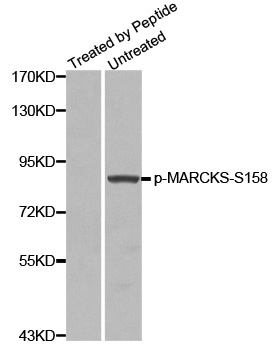 MARCKS Antibody - Western blot analysis of extracts from 3T3 cells.