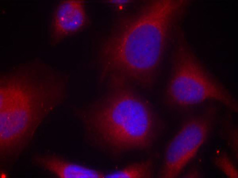 MARCKS Antibody - Immunofluorescence staining of methanol-fixed Hela cells.