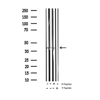 MARCKS Antibody - Western blot analysis of Phospho-MARCKS (Ser158) antibody expression in mouse heart and rat lung tissues lysates.