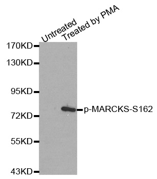 MARCKS Antibody - Western blot analysis of extracts from 293 cells.