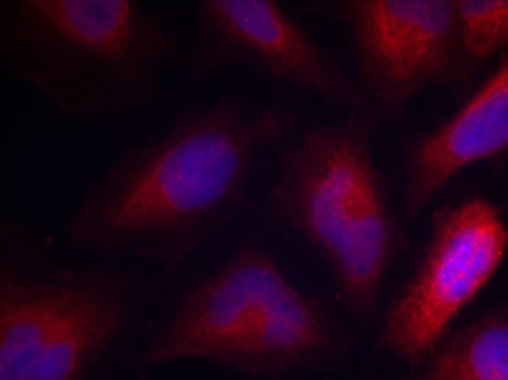 MARCKS Antibody - Immunofluorescence staining of methanol-fixed Hela cells.