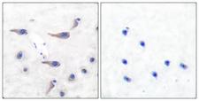 MARCKS Antibody - Immunohistochemistry analysis of paraffin-embedded human brain, using MARCKS (Phospho-Ser163) Antibody. The picture on the right is blocked with the phospho peptide.