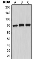 MARCKS Antibody - Western blot analysis of MARCKS (pS163) expression in MCF7 PMA-treated (A); SP2/0 PMA-treated (B); PC12 PMA-treated (C) whole cell lysates.