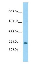 MARCKSL1 Antibody - MARCKSL1 / MRP antibody Western Blot of 293T.  This image was taken for the unconjugated form of this product. Other forms have not been tested.