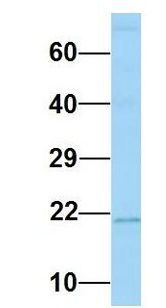 MARCKSL1 Antibody - MARCKSL1 / MRP antibody Western Blot of Human Fetal Lung. Antibody Dilution: 1.0 ug/ml. Antibody dilution: 1 ug/ml.  This image was taken for the unconjugated form of this product. Other forms have not been tested.