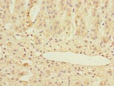 MARCKSL1 Antibody - Immunohistochemistry of paraffin-embedded human adrenal gland tissue at dilution 1:100