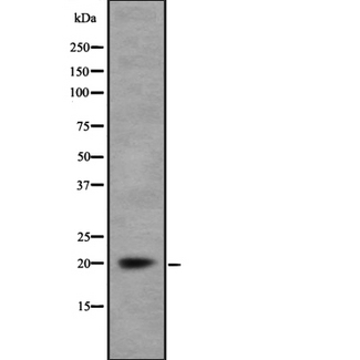 MARCKSL1 Antibody - Western blot analysis of MRP using Jurkat whole cells lysates