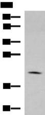 MARCKSL1 Antibody - Western blot analysis of RAW264.7 cell lysate  using MARCKSL1 Polyclonal Antibody at dilution of 1:750
