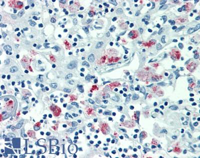 MARCO Antibody - Human Thymus: Formalin-Fixed, Paraffin-Embedded (FFPE)