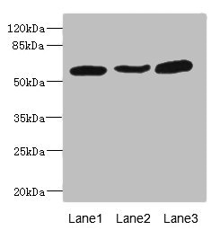 MARCO Antibody - Western blot All Lanes: MARCO antibody at 1.97ug/ml Lane 1: Jurkat whole cell lysate Lane 2: A549 whole cell lysate Lane 3: HepG-2 whole cell lysate Secondary Goat polyclonal to rabbit IgG at 1/10000 dilution Predicted band size: 53,44 kDa Observed band size: 53 kDa